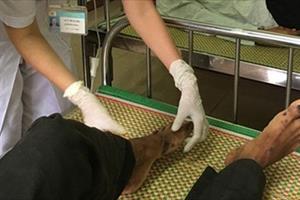 Bộ Y tế yêu cầu giám sát “bệnh lạ” tái xuất tại Quảng Ngãi