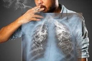 Cách đơn giản để phòng tránh ung thư phổi