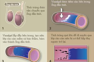 Loại thuốc giúp đàn ông tránh thai trong 2 năm