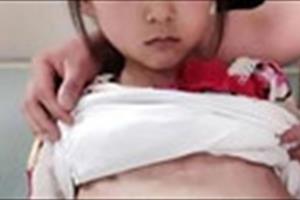 Điều tra vụ bé gái 12 tuổi mang thai nghi bị bán sang Trung Quốc